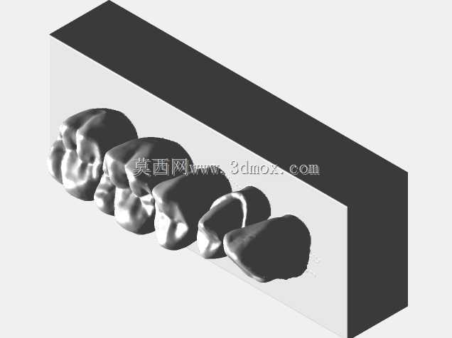 备牙-肩部精加工线
