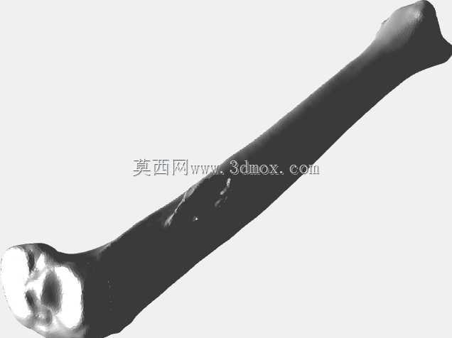 人类胫骨
