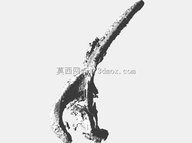 肩胛骨骨折