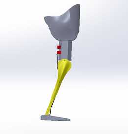  prothetic�ȵ����뷨