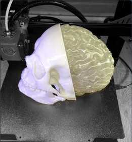 带脑的头骨