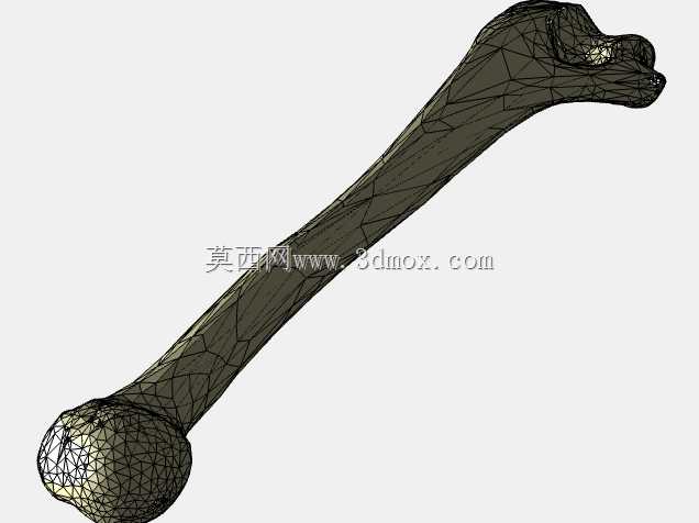 ���Źǹ����ϼ��� / Protese osseointegrada transhumeral