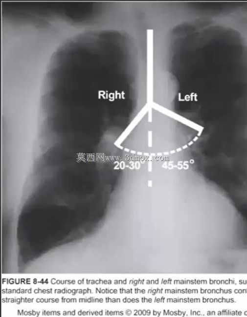 ������ - ��֫���