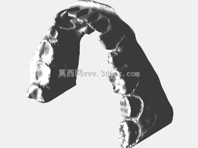 金属冠状动脉