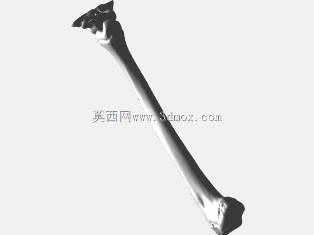 青少年胫骨内翻高精度3D模型 - 详细的骨科教学工具 说明: 通过我们精心制作的3D模型,探索青少年胫骨内翻的复杂性,是骨科医生