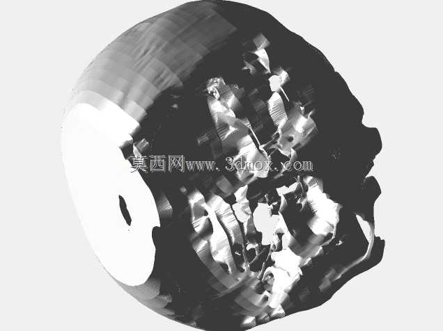 颅骨发育不全
