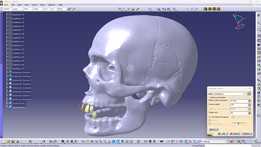 ����ͷ��3Dɨ��