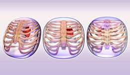 Stratasys Medical Pe