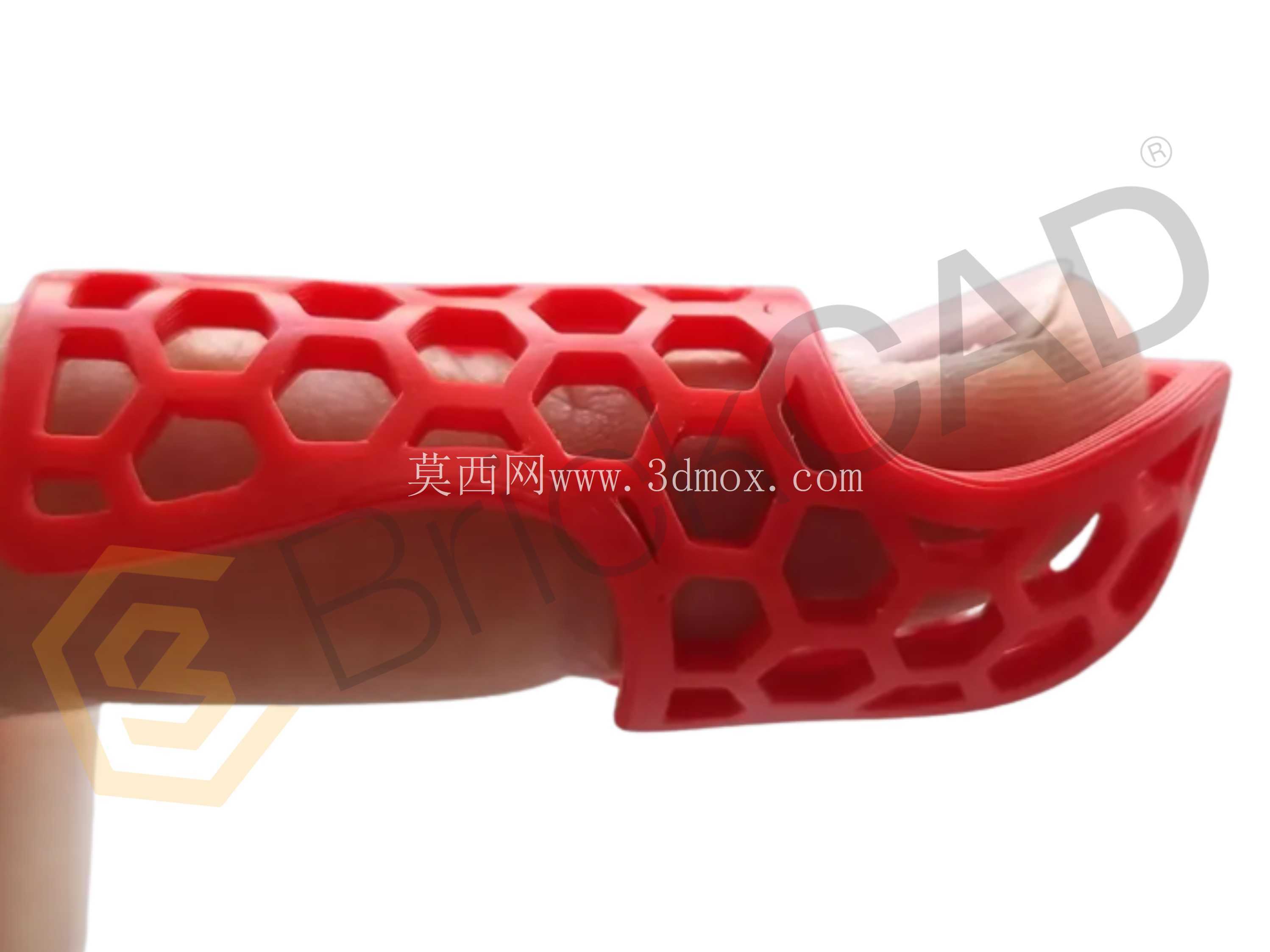 手指矫正支架 – 3D 可打印 CAD 模型 | SolidWorks 骨科辅助设备设计