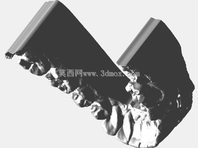 Zirkonzahn上颚贴面