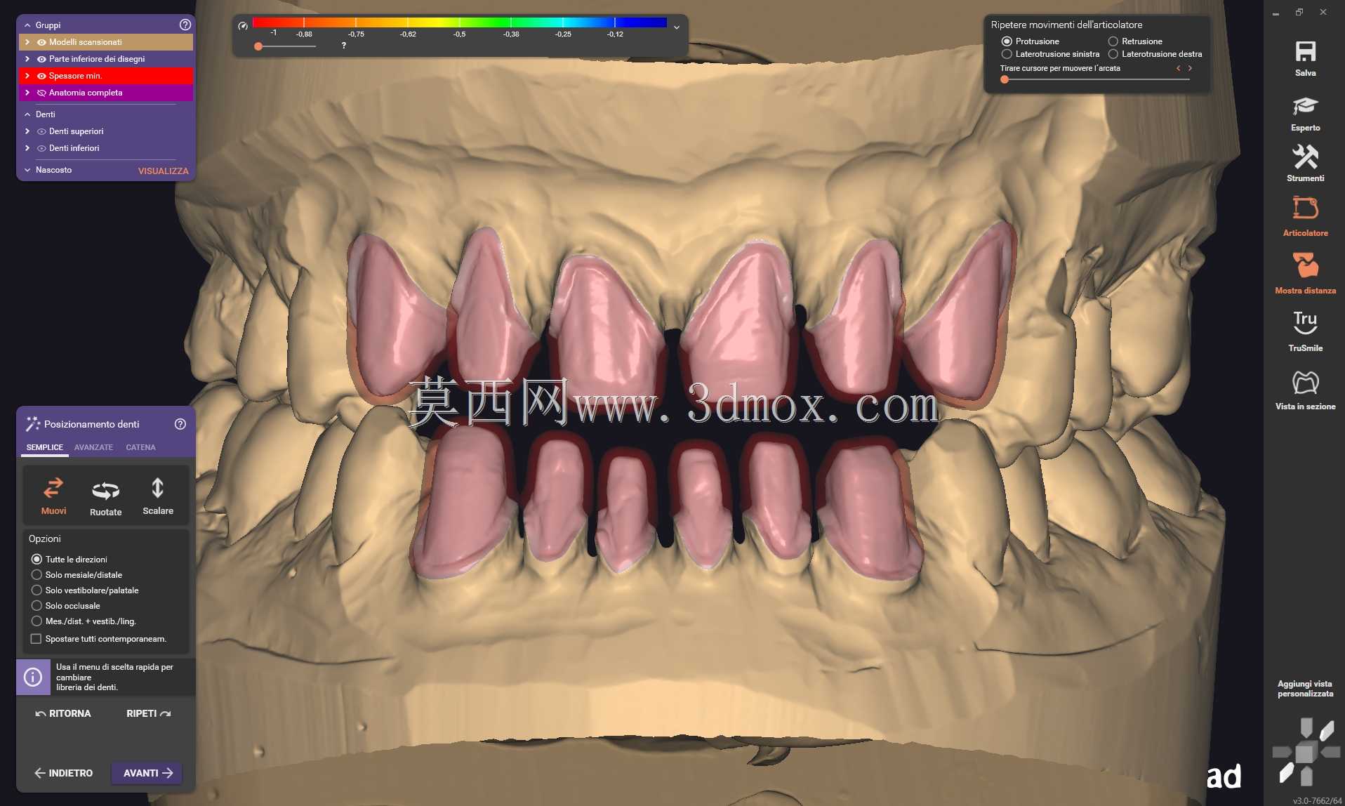 Exocad Galway 3.0ǰ����Ŀ