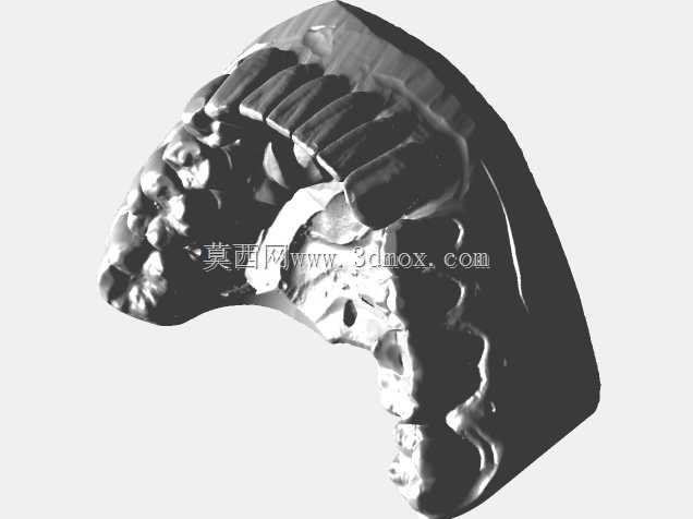 Exocad Galway 3.0ǰ����Ŀ