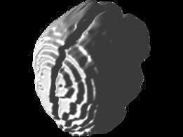 MRI��ɨ�赽3Dģ��