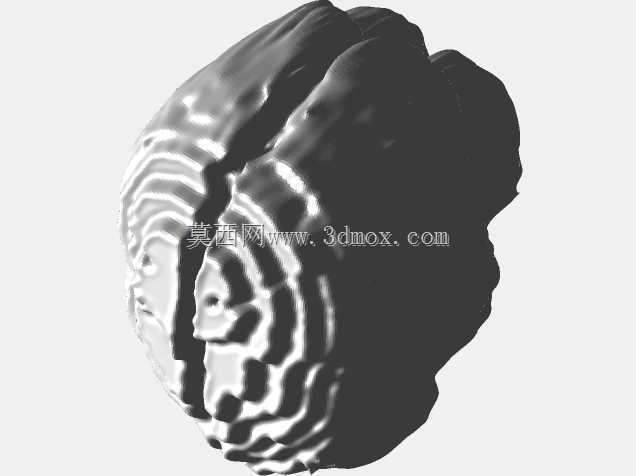 MRI��ɨ�赽3Dģ��