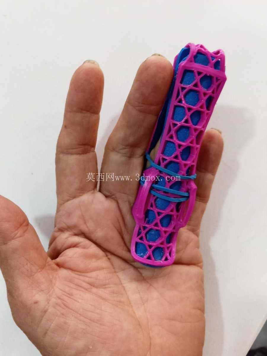 手指矫形器-可热成型3D打印