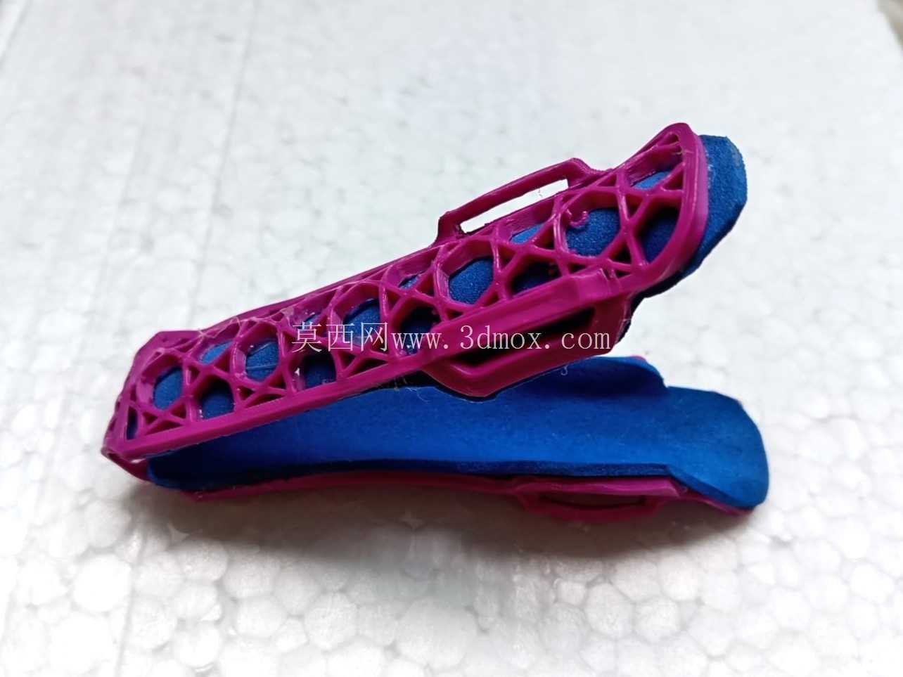 手指矫形器-可热成型3D打印