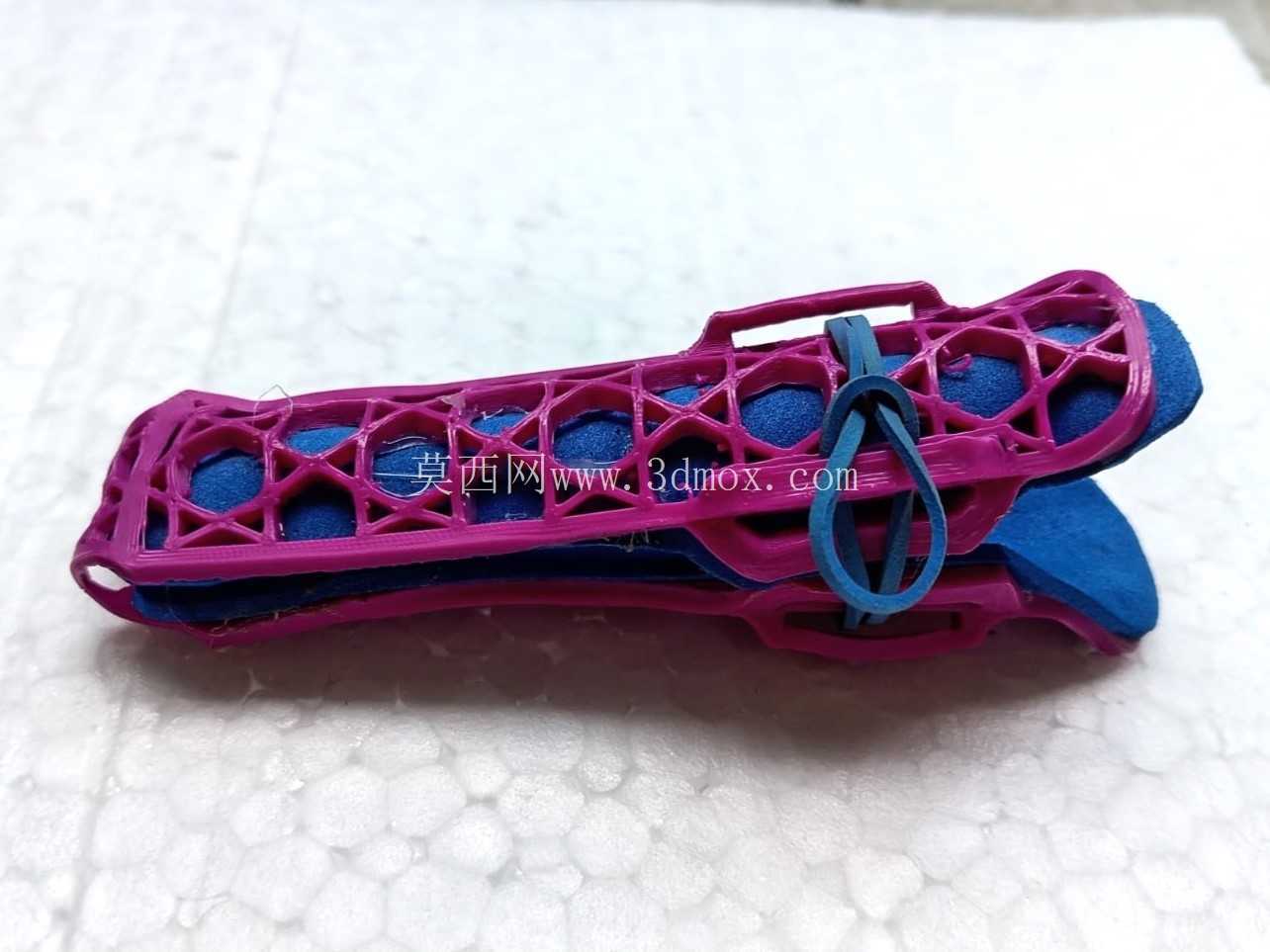 手指矫形器-可热成型3D打印