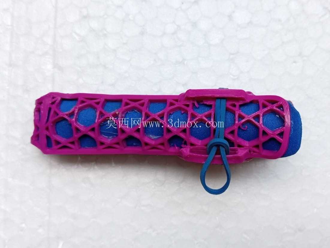 手指矫形器-可热成型3D打印