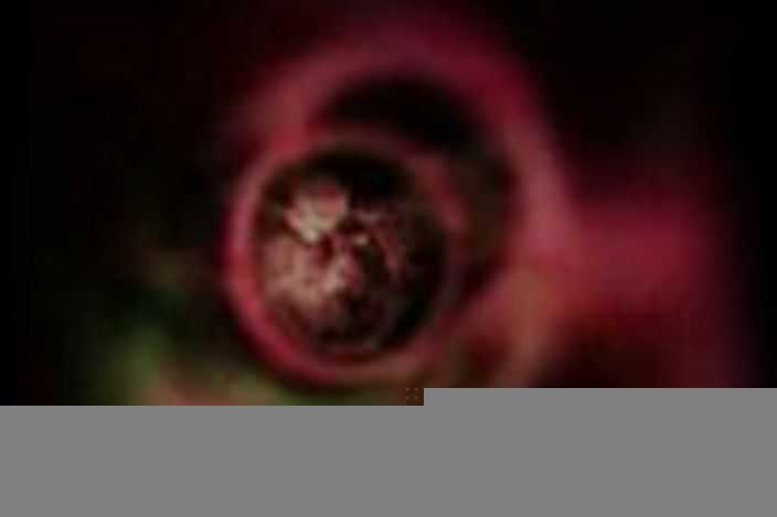 ҽ��˭��˹
