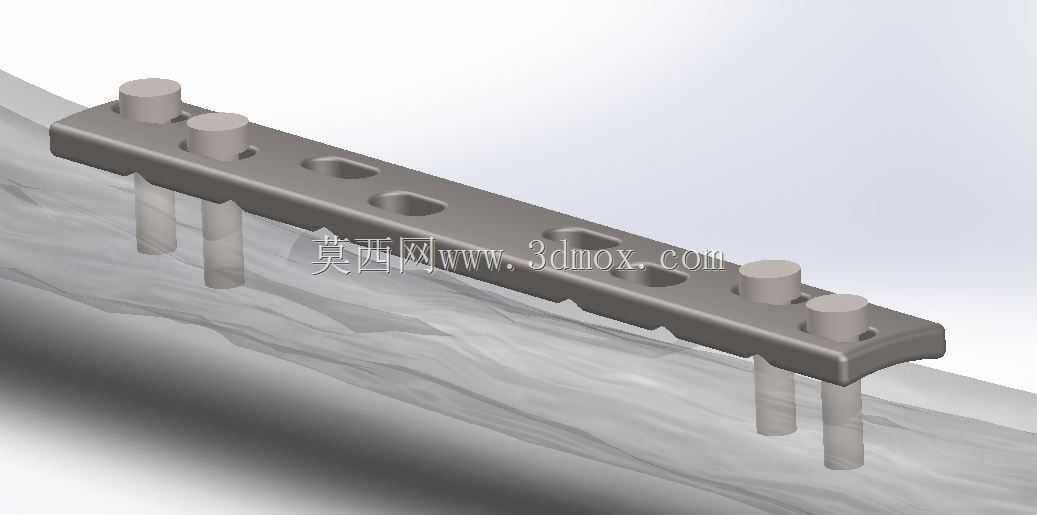 4.5mm��DCP�ְ壨�ǹ̶���