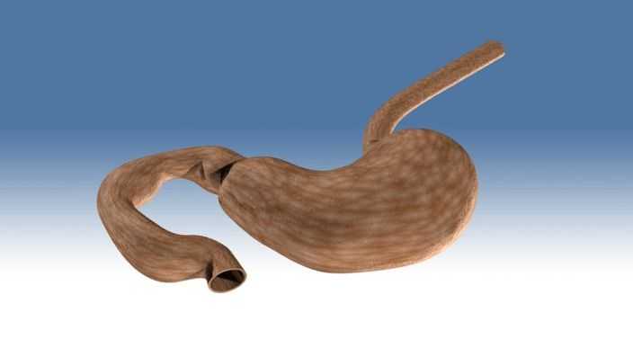 2012_Stomach��Esophagus.ics
