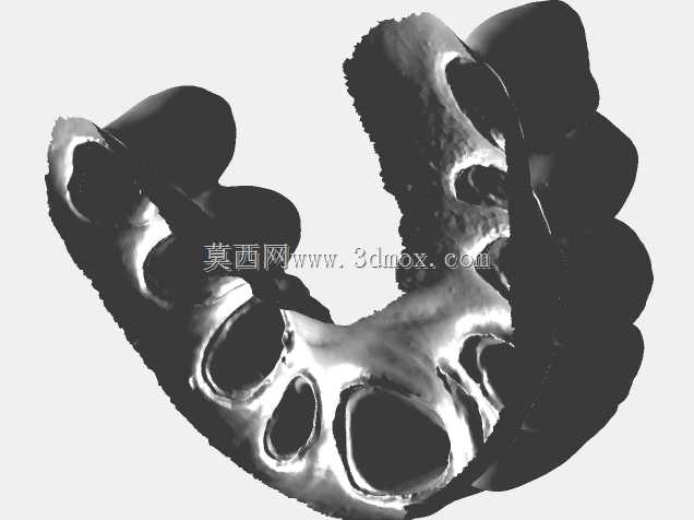 Zirkonzahn上颌温度桥