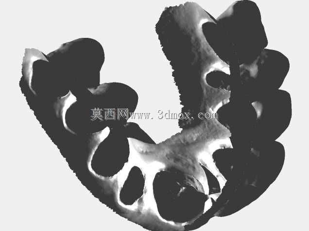 Zirkonzahn上颌温度桥