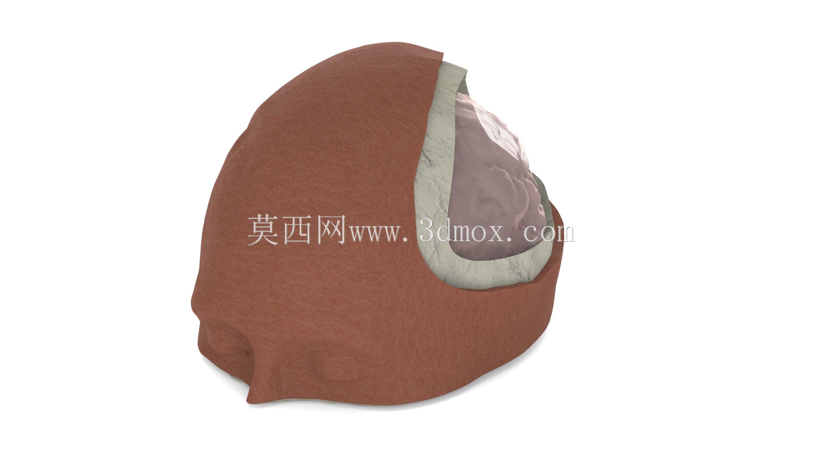 医学培训师-脑膜瘤切除术颅骨
