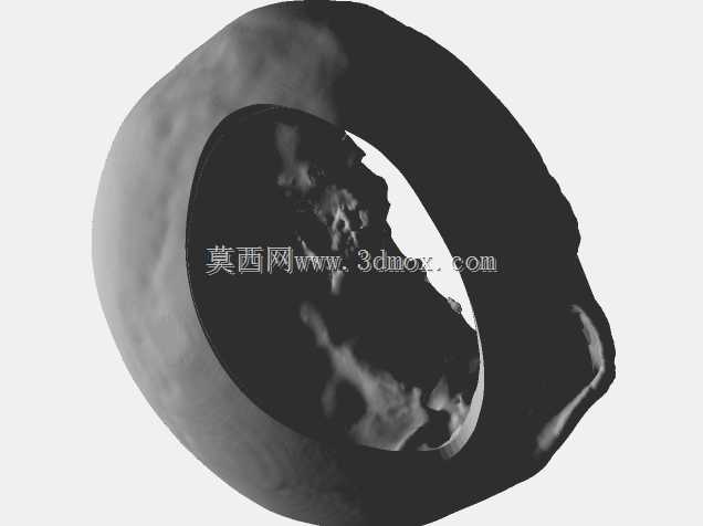 医学培训师-脑膜瘤切除术颅骨
