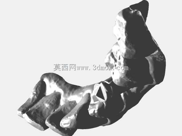 嵌体种植冠下颌