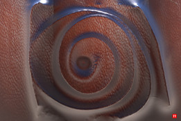 ͹����A1
