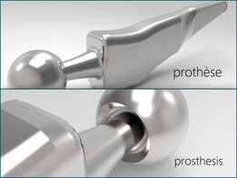 ����| proth��se