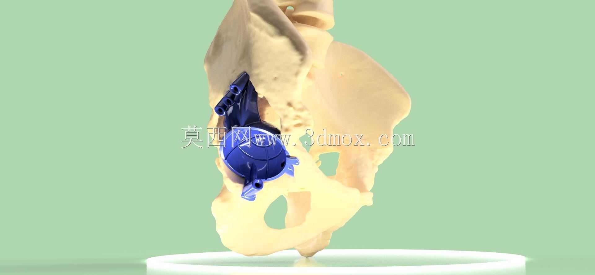 �Źؽ�ǻֲ����