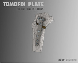 �ֹ�TOMOFIX�ְ�����H