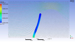 超弹性皮瓣-ANSYS-