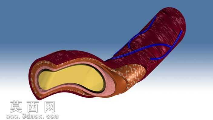 Artery.ics
