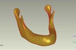 Jaw_3D_Model