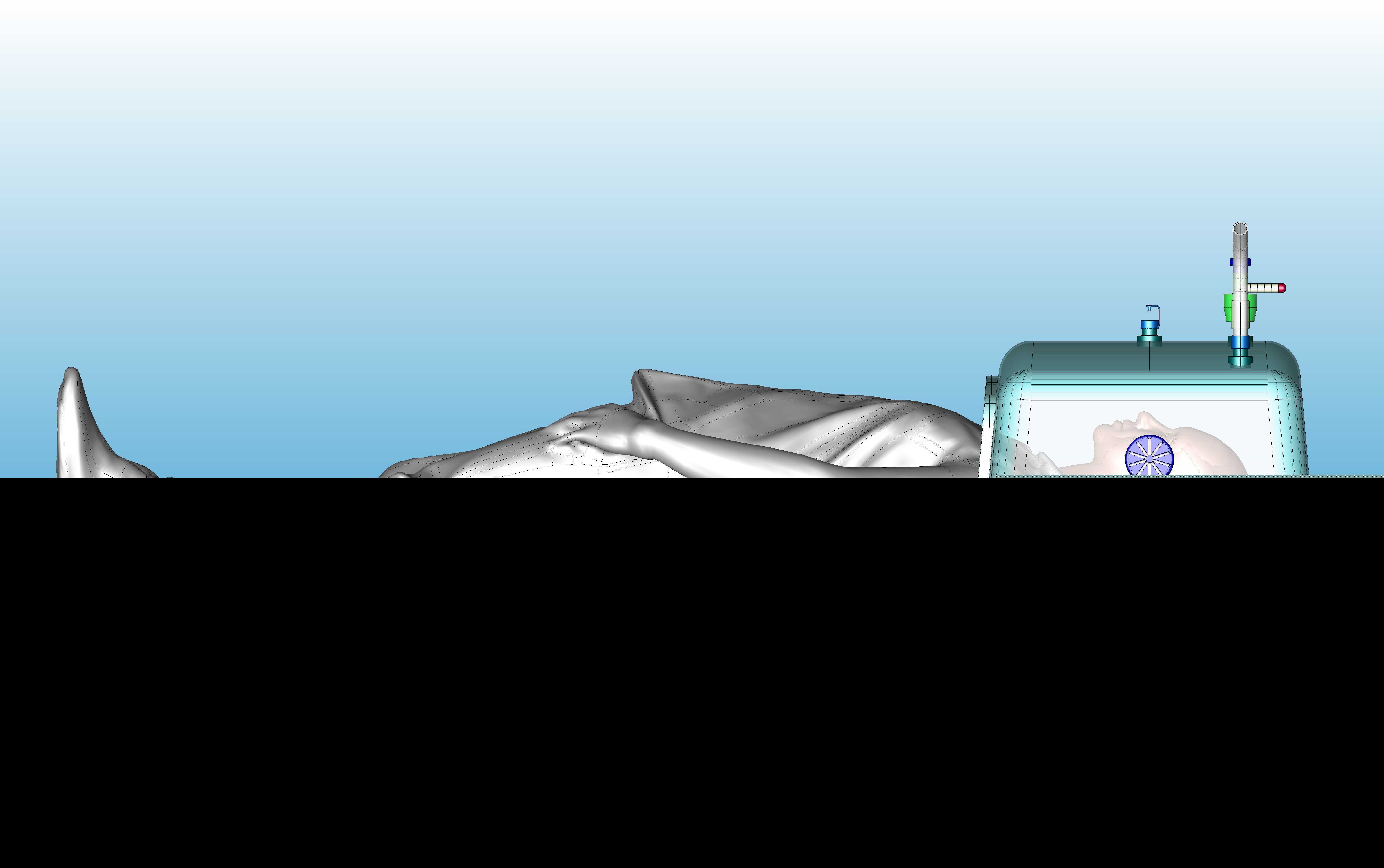 圆顶CPAP