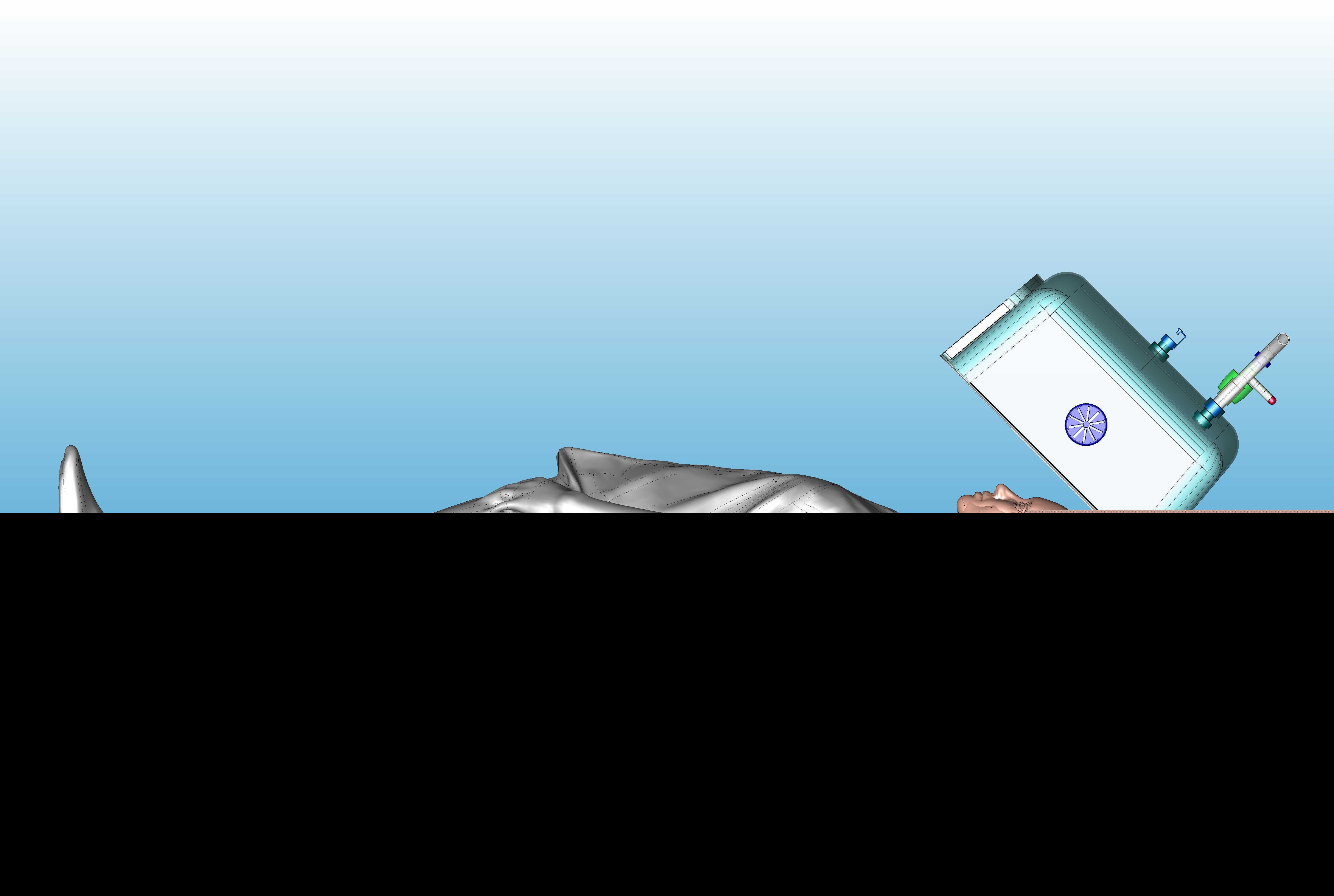圆顶CPAP
