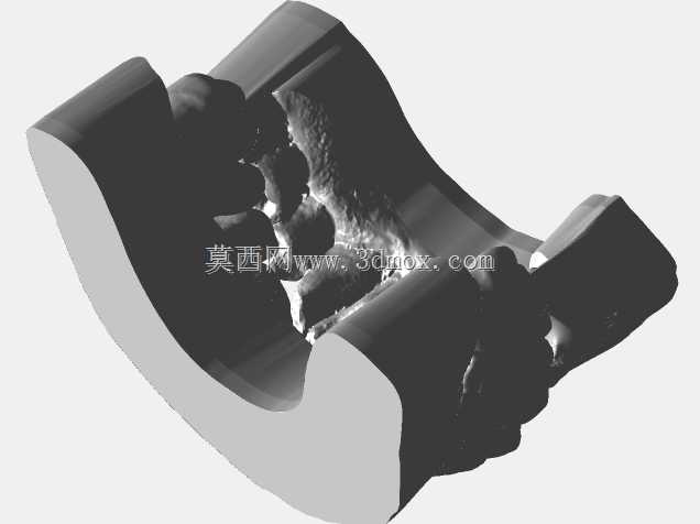 MUA上的Zirkonzahn皇冠(种植桥)