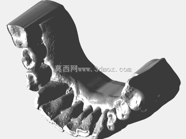 MUA上的Zirkonzahn皇冠(种植桥)