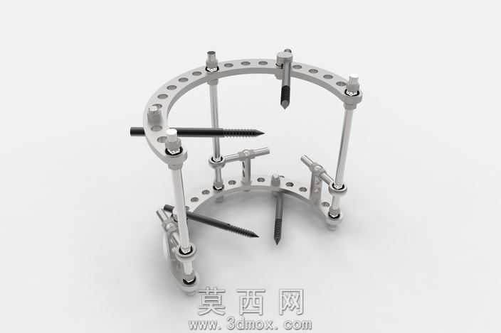 devdevice消除位移的骨头的碎片。伊利扎诺夫method.iceustrannen