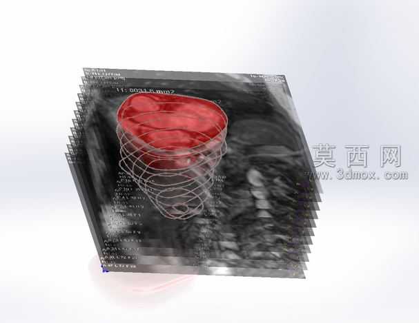CT����
