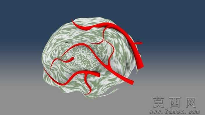 Tumor_SmallwѪҺVessels.ics
