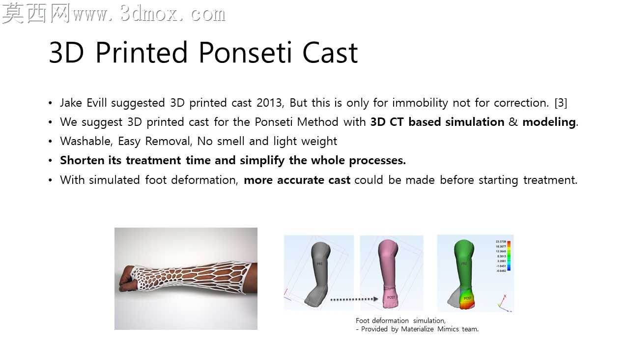 Ponseti������3D��ӡ����