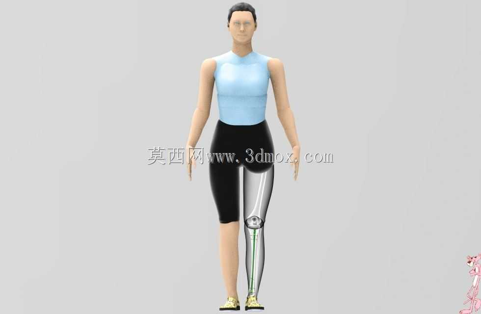 胫骨髓内钉