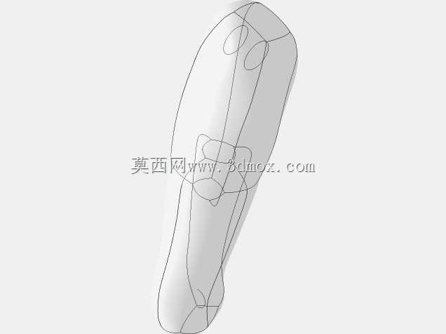 胫骨髓内钉
