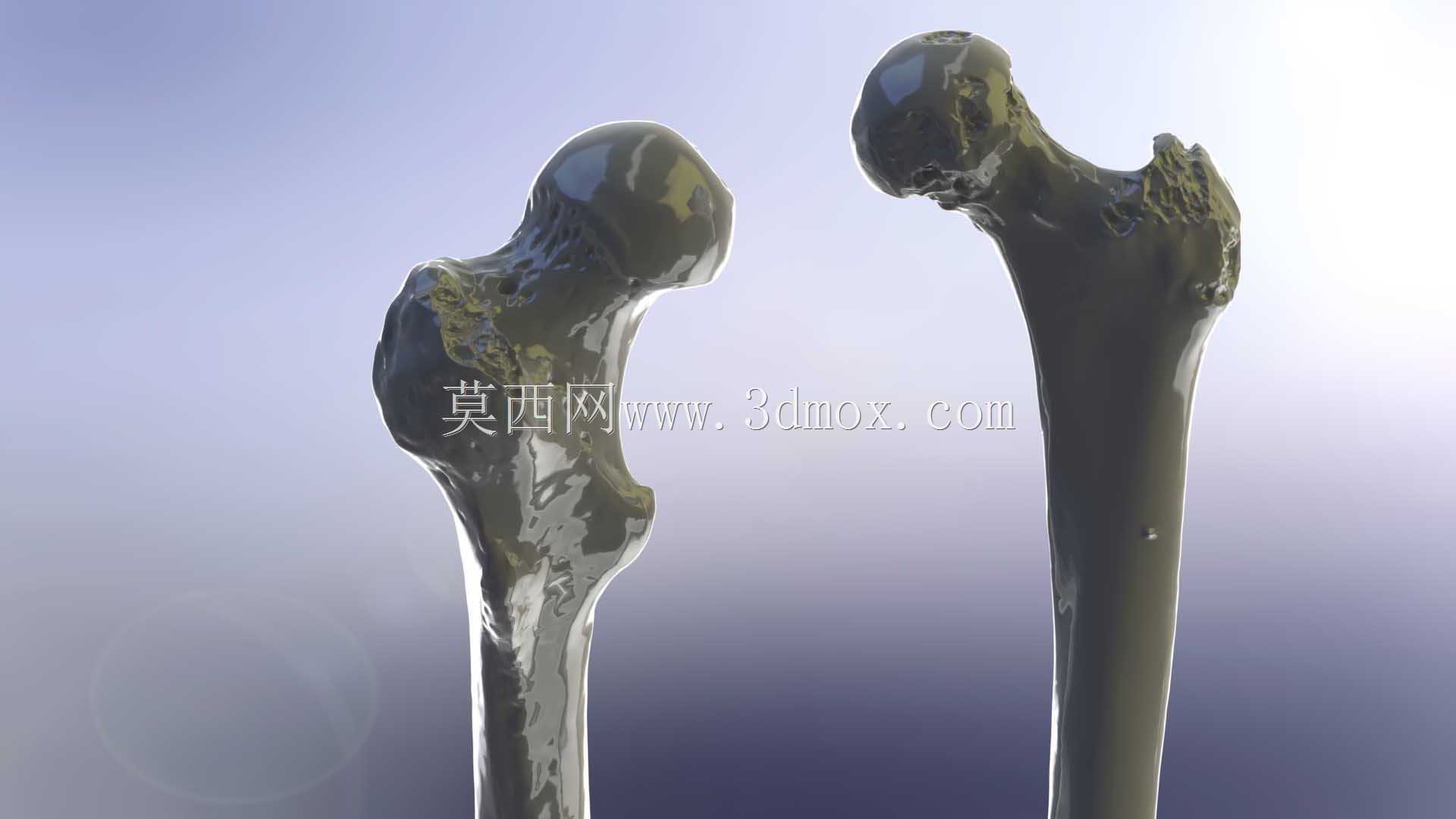 股骨