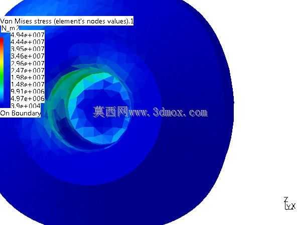 牙种植体设计与有限元分析