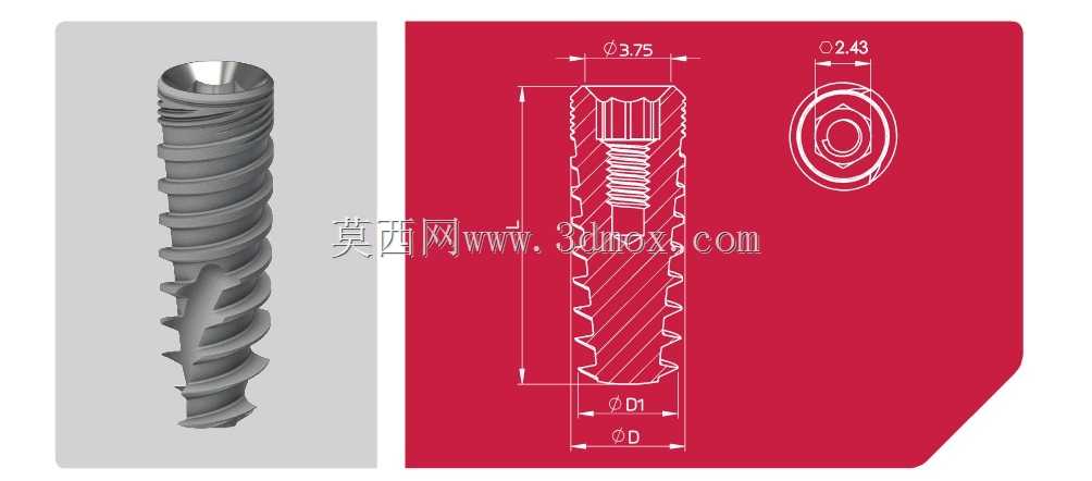 牙种植体设计与有限元分析